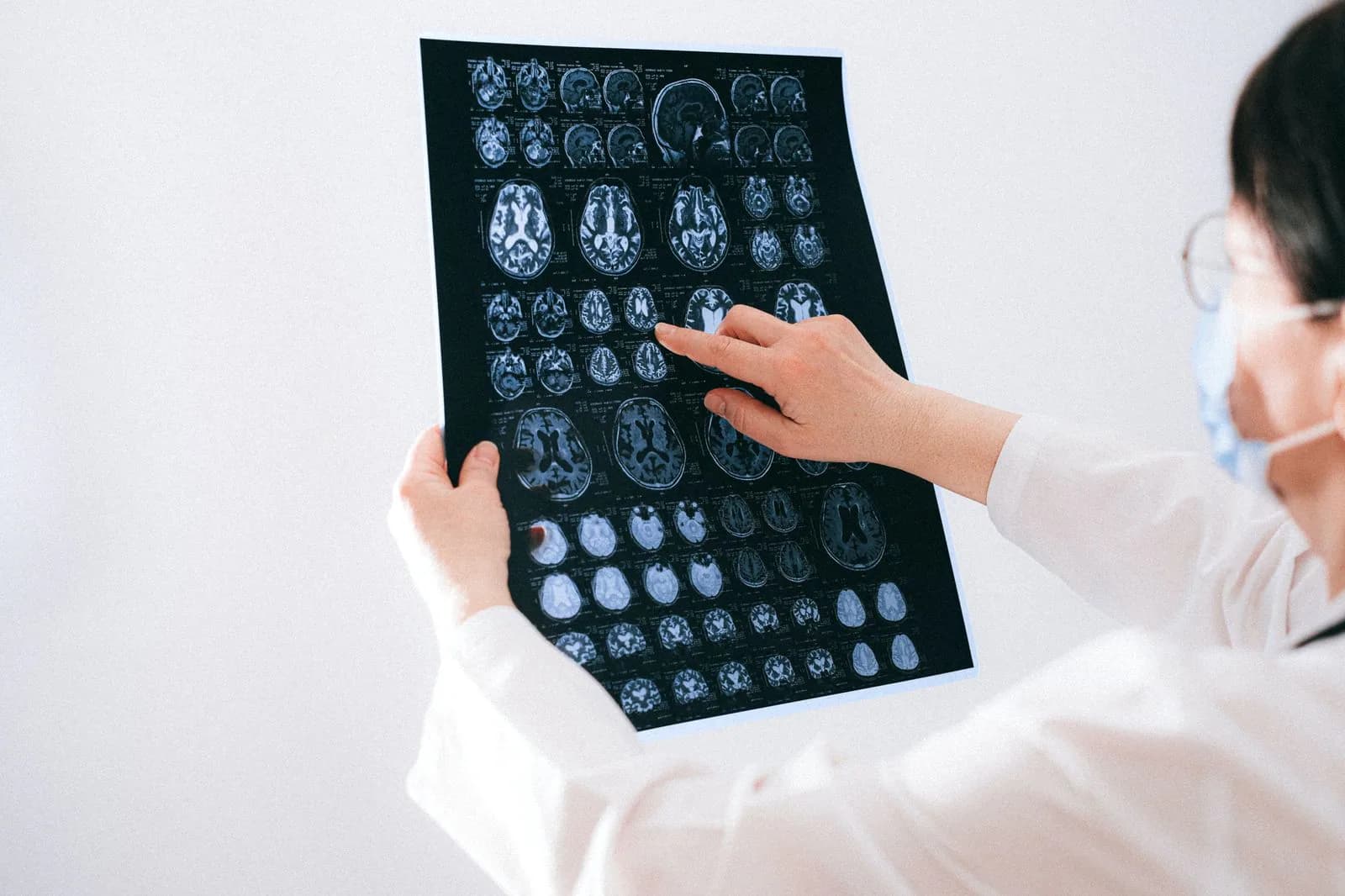 Nutritional strategies for preventing Alzheimer's disease