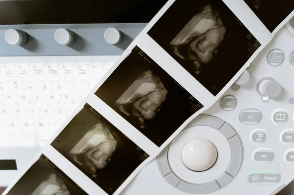 3D printing in healthcare