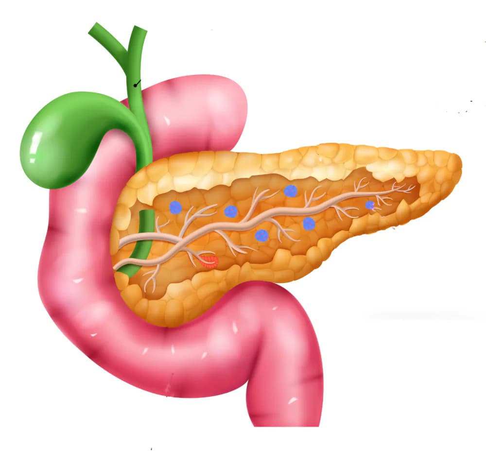 New research in pancreatic cancer screening